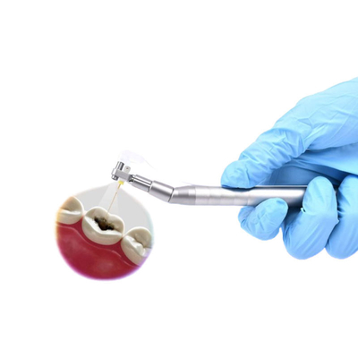 اندوسکوپ درون دهانی با دوربین کوچک دیجیتال بصری برای درمان کانال ریشه