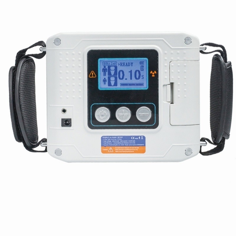 واحد اشعه ایکس قابل حمل دستگاه اشعه ایکس دندانپزشکی بی سیم